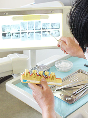 歯周病治療「YM療法」